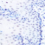 Immunohistochemistry - Anti-MiTF Antibody [ARC0660] (A306202) - Antibodies.com