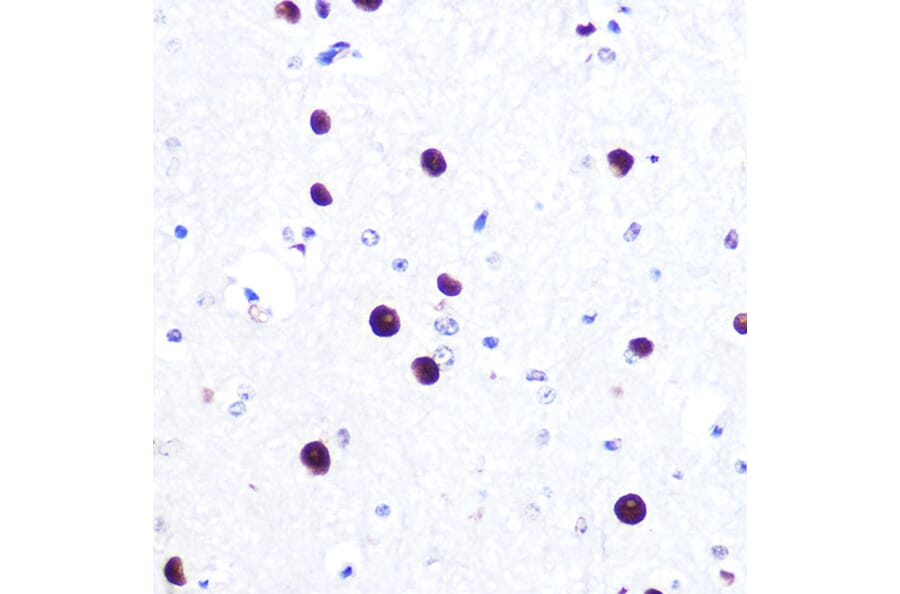 Immunohistochemistry - Anti-MiTF Antibody [ARC0660] (A306202) - Antibodies.com