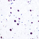 Immunohistochemistry - Anti-MiTF Antibody [ARC0660] (A306202) - Antibodies.com