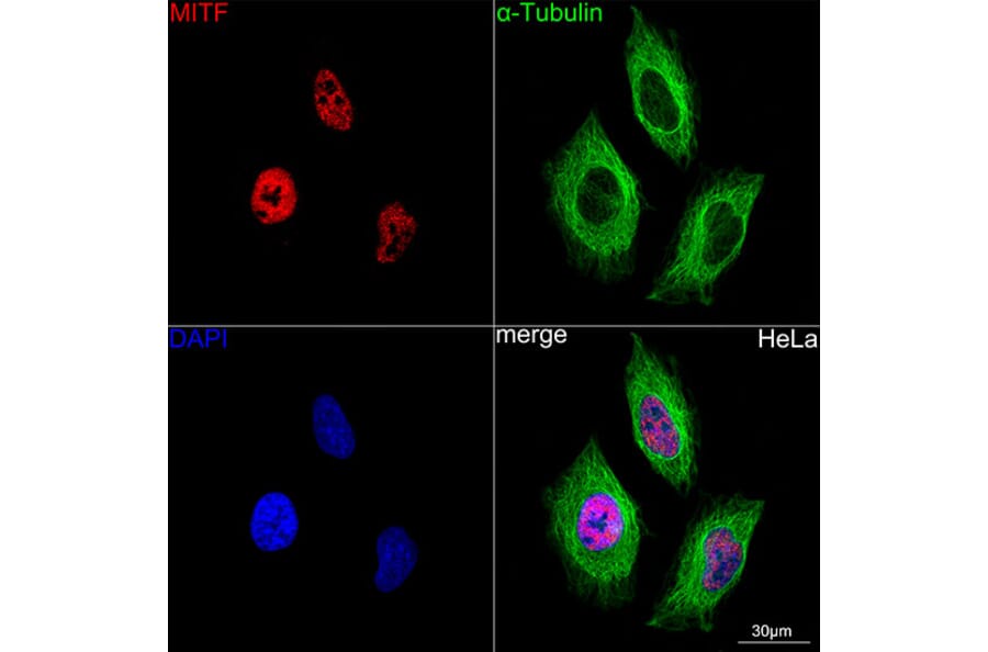 Immunofluorescence - Anti-MiTF Antibody [ARC0660] (A306202) - Antibodies.com