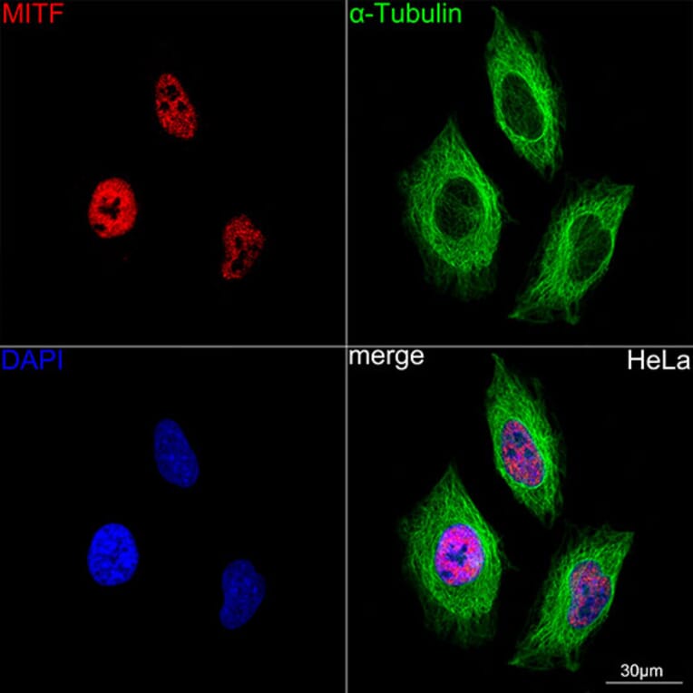 Immunofluorescence - Anti-MiTF Antibody [ARC0660] (A306202) - Antibodies.com