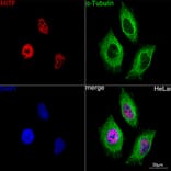 Immunofluorescence - Anti-MiTF Antibody [ARC0660] (A306202) - Antibodies.com