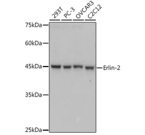 Western Blot - Anti-Erlin-2 Antibody [ARC2538] (A306203) - Antibodies.com