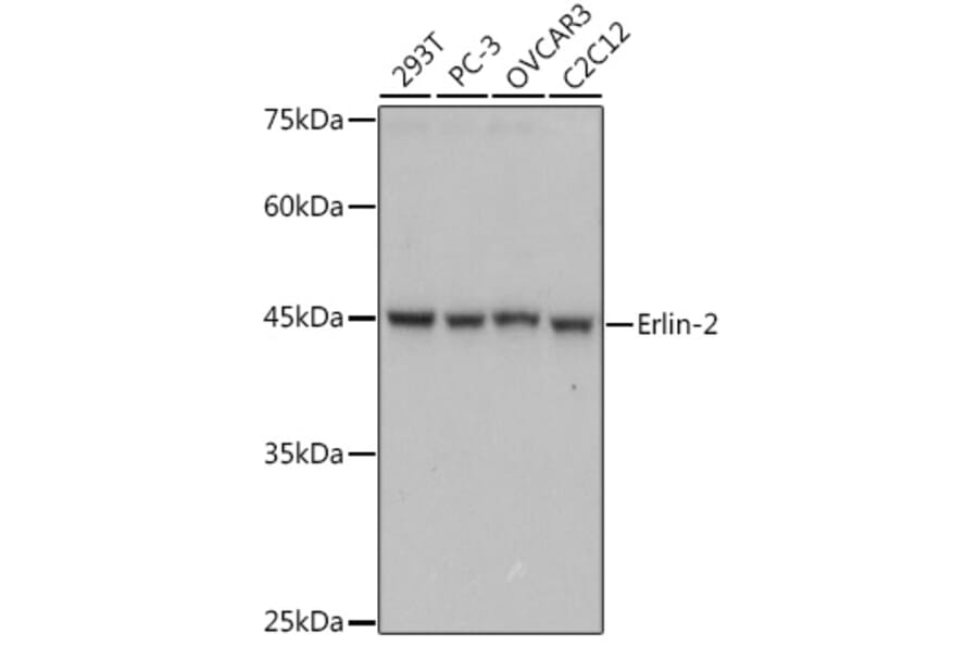Western Blot - Anti-Erlin-2 Antibody [ARC2538] (A306203) - Antibodies.com