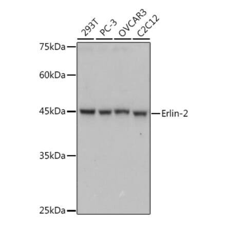 Western Blot - Anti-Erlin-2 Antibody [ARC2538] (A306203) - Antibodies.com