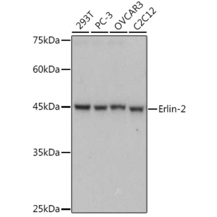 Western Blot - Anti-Erlin-2 Antibody [ARC2538] (A306203) - Antibodies.com
