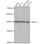 Western Blot - Anti-Erlin-2 Antibody [ARC2538] (A306203) - Antibodies.com
