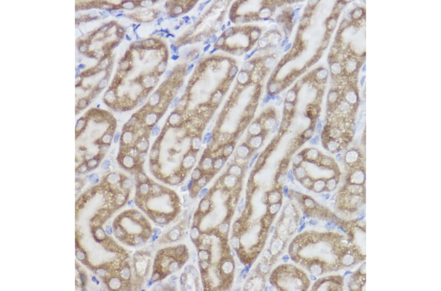 Immunohistochemistry - Anti-Erlin-2 Antibody [ARC2538] (A306203) - Antibodies.com
