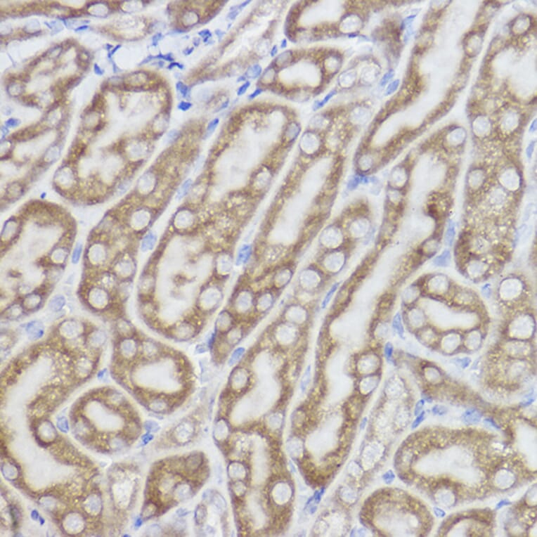 Immunohistochemistry - Anti-Erlin-2 Antibody [ARC2538] (A306203) - Antibodies.com
