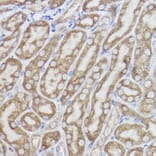 Immunohistochemistry - Anti-Erlin-2 Antibody [ARC2538] (A306203) - Antibodies.com