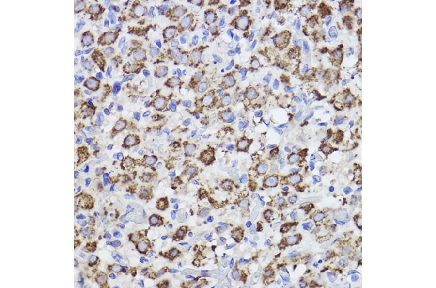 Immunohistochemistry - Anti-Erlin-2 Antibody [ARC2538] (A306203) - Antibodies.com