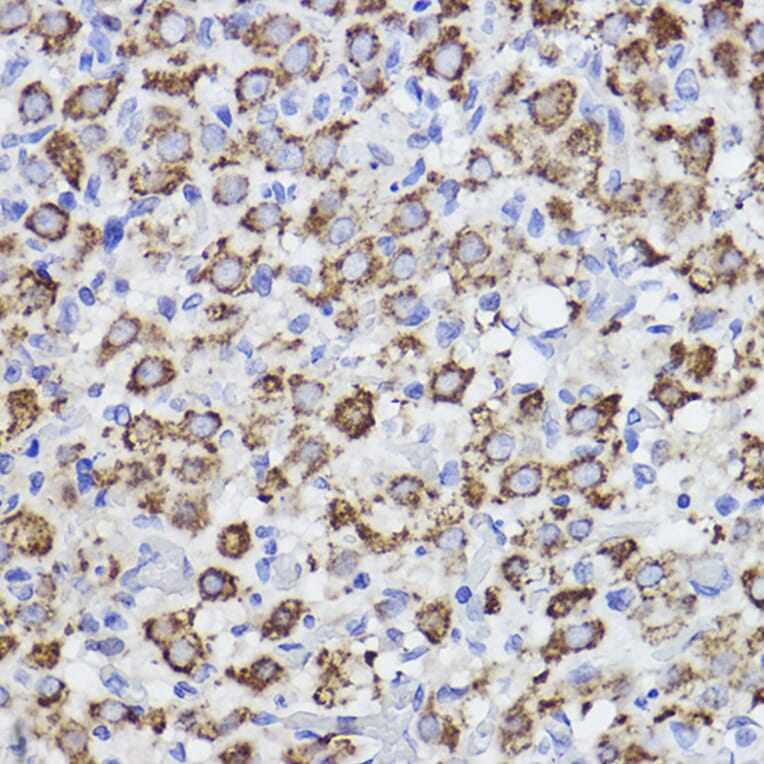 Immunohistochemistry - Anti-Erlin-2 Antibody [ARC2538] (A306203) - Antibodies.com