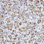 Immunohistochemistry - Anti-Erlin-2 Antibody [ARC2538] (A306203) - Antibodies.com