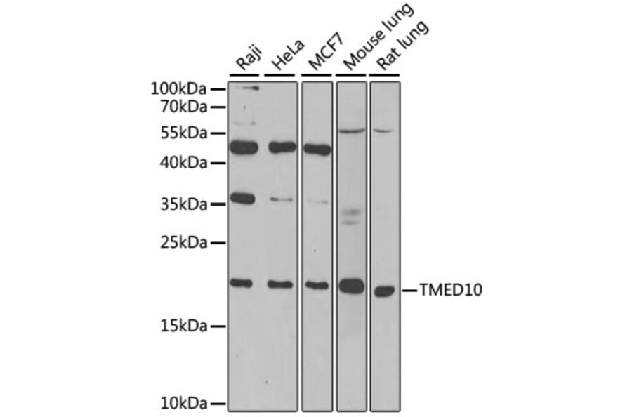 Western Blot - Anti-TMP21 Antibody (A306204) - Antibodies.com