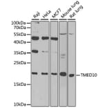 Western Blot - Anti-TMP21 Antibody (A306204) - Antibodies.com