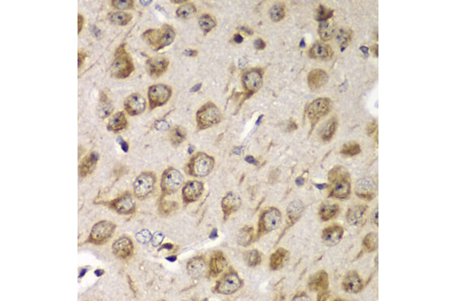 Immunohistochemistry - Anti-TMP21 Antibody (A306204) - Antibodies.com
