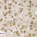 Immunohistochemistry - Anti-TMP21 Antibody (A306204) - Antibodies.com