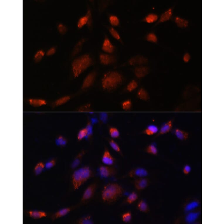 Immunofluorescence - Anti-TMP21 Antibody (A306204) - Antibodies.com