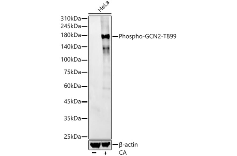 Western Blot - Anti-GCN2 (phospho Thr899) Antibody [ARC57177] (A306206) - Antibodies.com