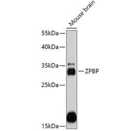 Western Blot - Anti-ZPBP Antibody (A306207) - Antibodies.com