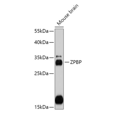 Western Blot - Anti-ZPBP Antibody (A306207) - Antibodies.com