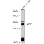 Western Blot - Anti-ZPBP Antibody (A306207) - Antibodies.com