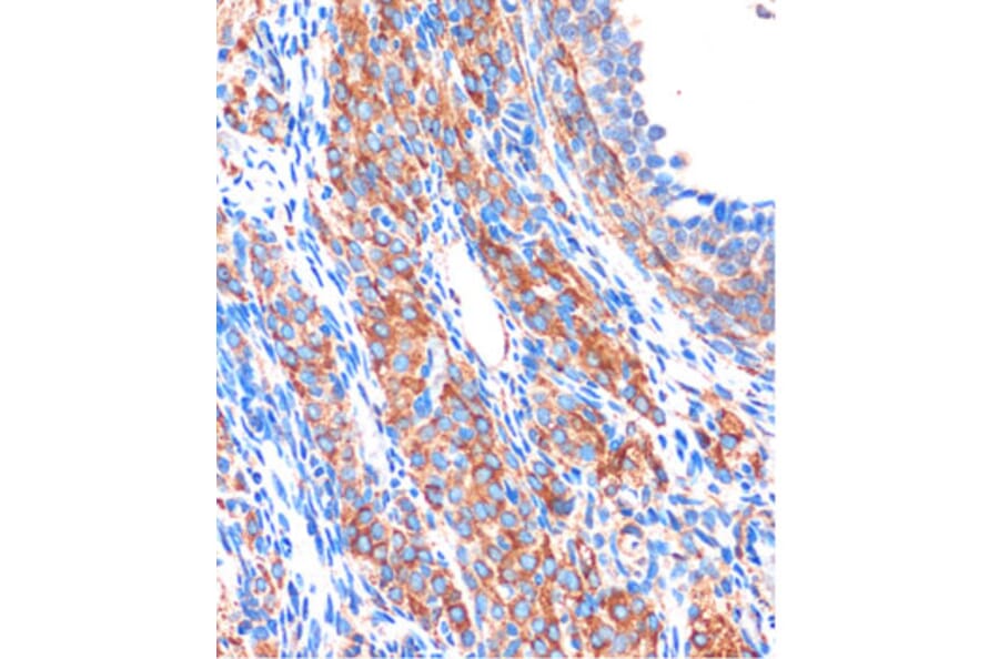 Immunohistochemistry - Anti-ZPBP Antibody (A306207) - Antibodies.com