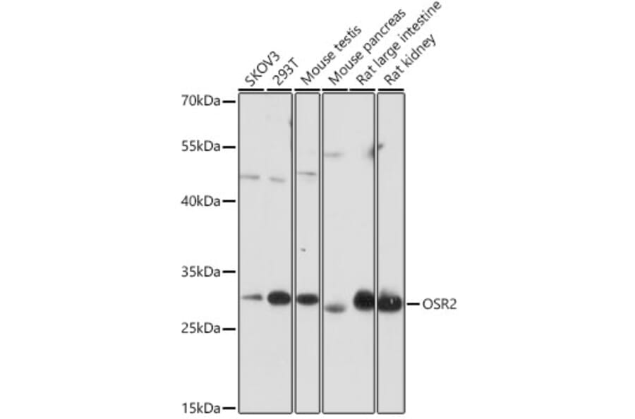 Western Blot - Anti-OSR2 Antibody (A306208) - Antibodies.com