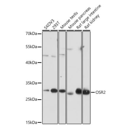 Western Blot - Anti-OSR2 Antibody (A306208) - Antibodies.com