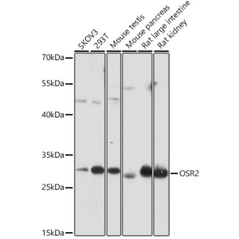 Western Blot - Anti-OSR2 Antibody (A306208) - Antibodies.com