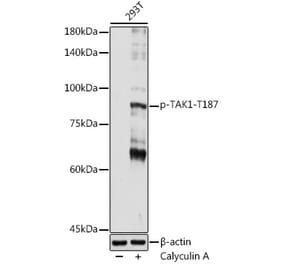Western Blot - Anti-TAK1 (phospho Thr187) Antibody (A306209) - Antibodies.com