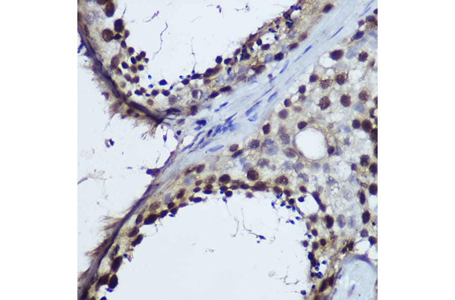 Immunohistochemistry - Anti-TET1 Antibody (A306212) - Antibodies.com