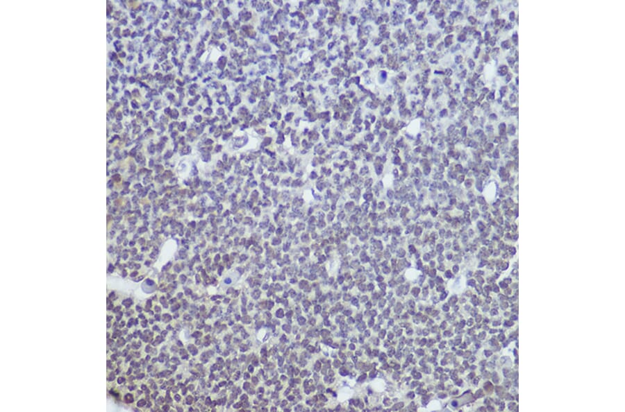 Immunohistochemistry - Anti-TET1 Antibody (A306212) - Antibodies.com