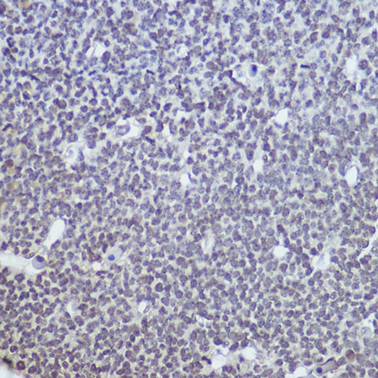 Immunohistochemistry - Anti-TET1 Antibody (A306212) - Antibodies.com
