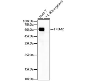 Western Blot - Anti-TREM2 Antibody [ARC55114] (A306213) - Antibodies.com