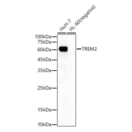 Western Blot - Anti-TREM2 Antibody [ARC55114] (A306213) - Antibodies.com