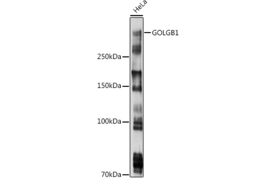 Western Blot - Anti-Giantin Antibody (A306214) - Antibodies.com