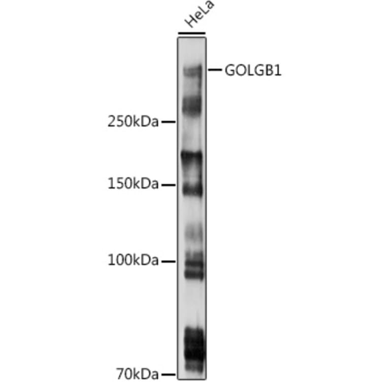 Western Blot - Anti-Giantin Antibody (A306214) - Antibodies.com