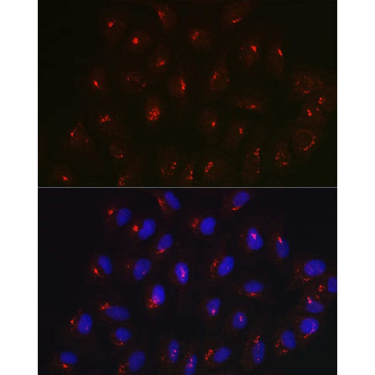 Immunofluorescence - Anti-Giantin Antibody (A306214) - Antibodies.com
