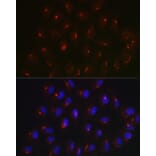 Immunofluorescence - Anti-Giantin Antibody (A306214) - Antibodies.com