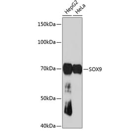 Western Blot - Anti-SOX9 Antibody [ARC0190] (A306215) - Antibodies.com