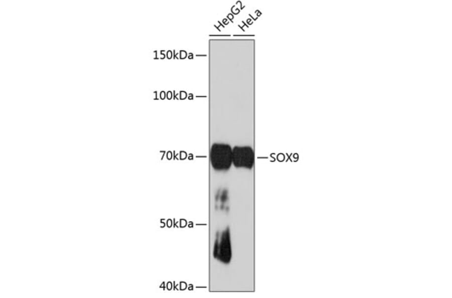 Western Blot - Anti-SOX9 Antibody [ARC0190] (A306215) - Antibodies.com