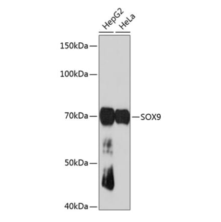 Western Blot - Anti-SOX9 Antibody [ARC0190] (A306215) - Antibodies.com