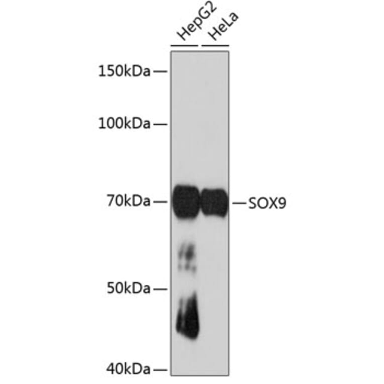 Western Blot - Anti-SOX9 Antibody [ARC0190] (A306215) - Antibodies.com
