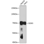 Western Blot - Anti-SOX9 Antibody [ARC0190] (A306215) - Antibodies.com