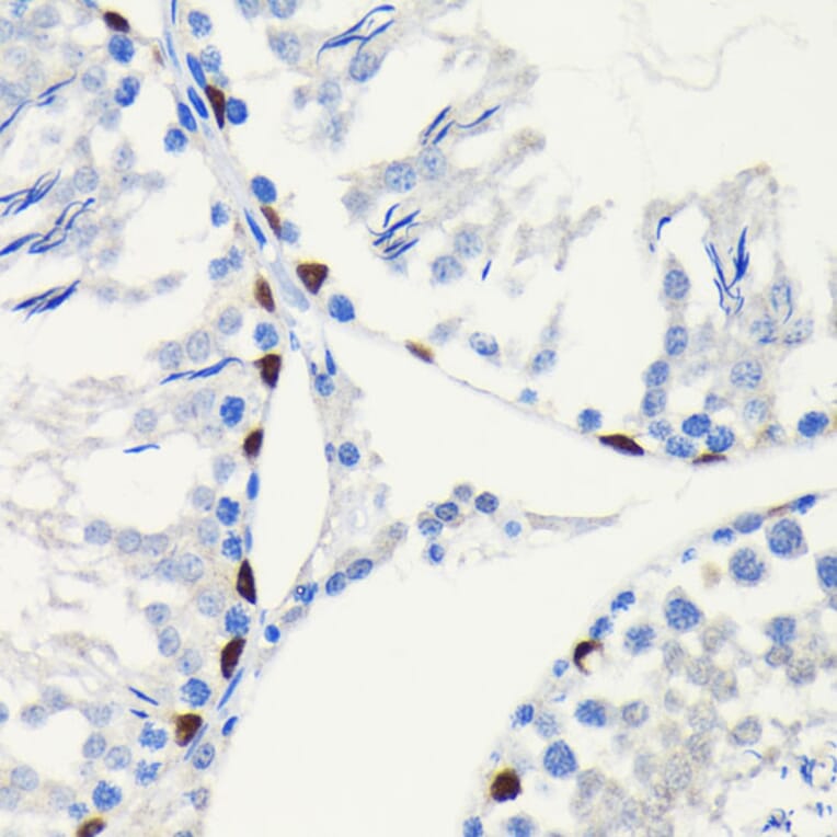 Immunohistochemistry - Anti-SOX9 Antibody [ARC0190] (A306215) - Antibodies.com