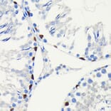 Immunohistochemistry - Anti-SOX9 Antibody [ARC0190] (A306215) - Antibodies.com