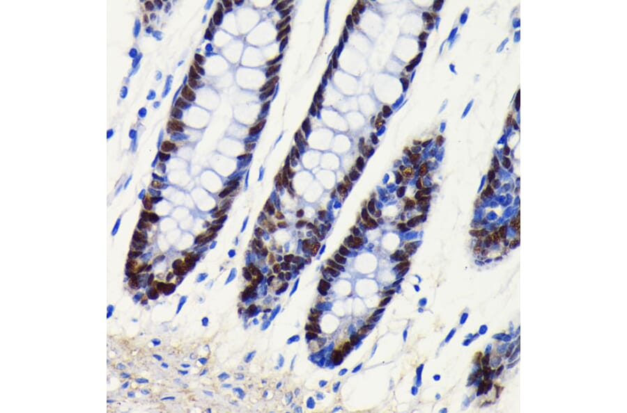Immunohistochemistry - Anti-SOX9 Antibody [ARC0190] (A306215) - Antibodies.com