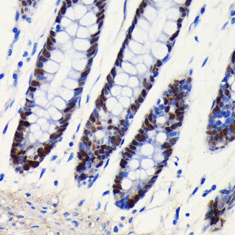 Immunohistochemistry - Anti-SOX9 Antibody [ARC0190] (A306215) - Antibodies.com