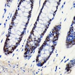 Immunohistochemistry - Anti-SOX9 Antibody [ARC0190] (A306215) - Antibodies.com